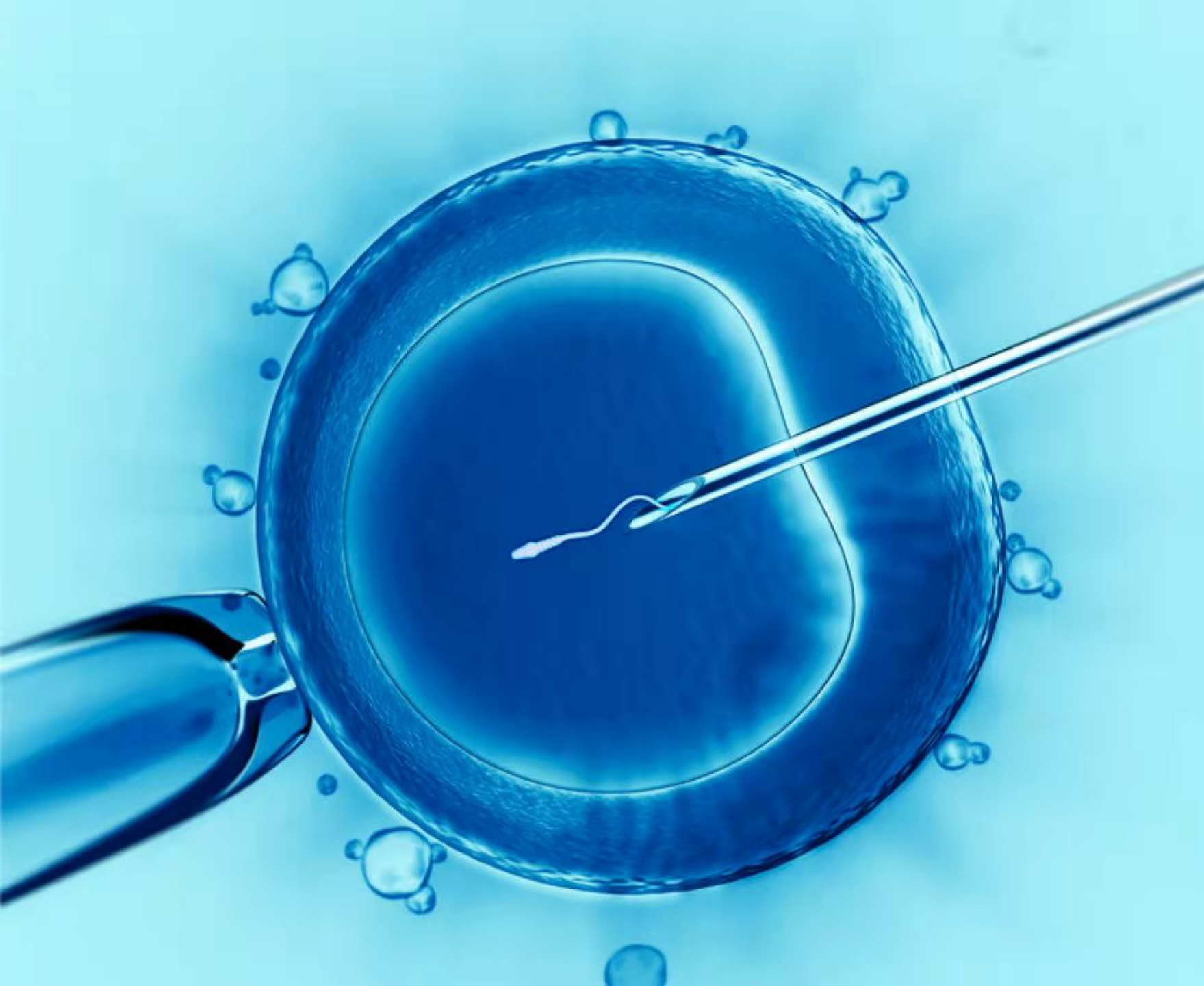 试管婴儿超声检查