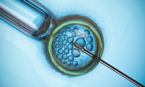 试管婴儿辅助生殖技术补贴政策